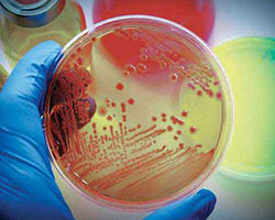 Bacterial Endocarditis Therapeutics - Pipeline Analysis 2018