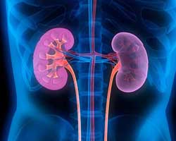 Immunoglobulin A (IgA) Nephropathy 