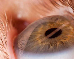 Presbyopia Therapeutics