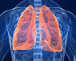 Interstitial Lung Disease Therapeutics - Pipeline Analysis 2018