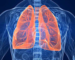 Pleural Effusion Therapeutics - Pipeline Analysis 2018